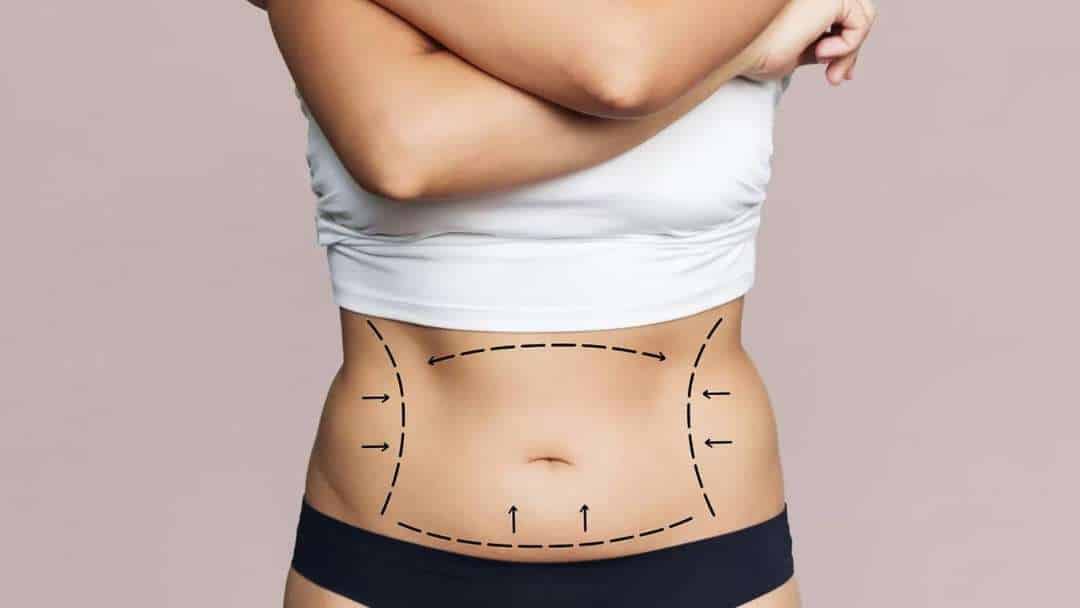 Dicas Para Manter Os Resultados Da Abdominoplastia